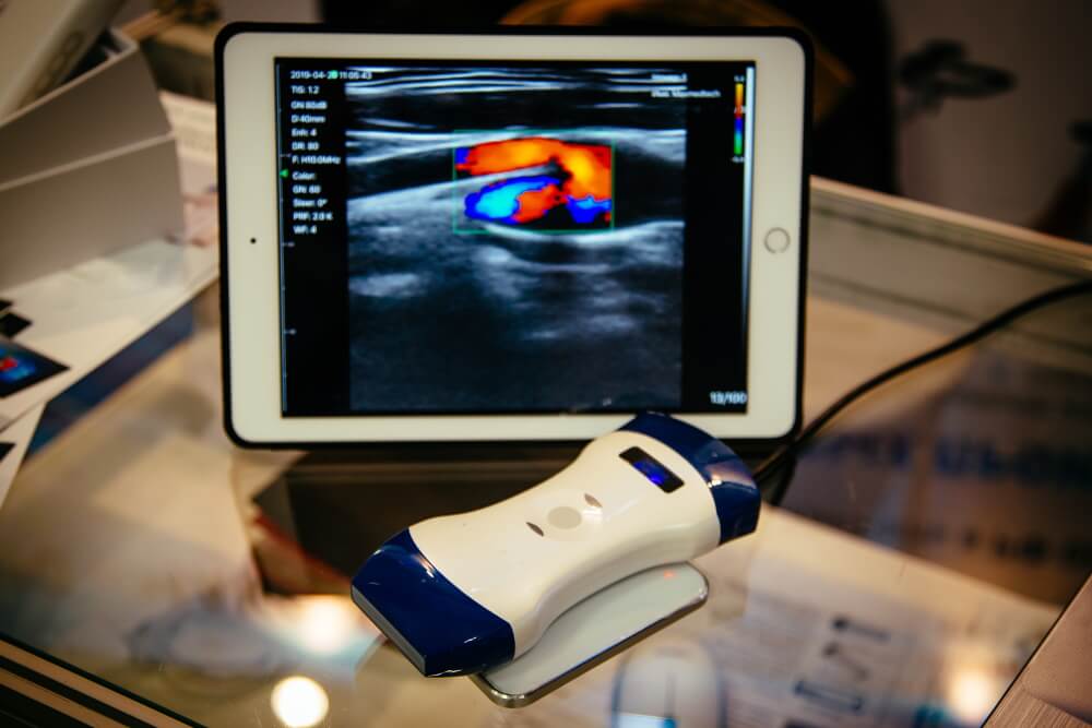 Pourquoi utiliser un scanner à ultrasons portable ? - Kalstein