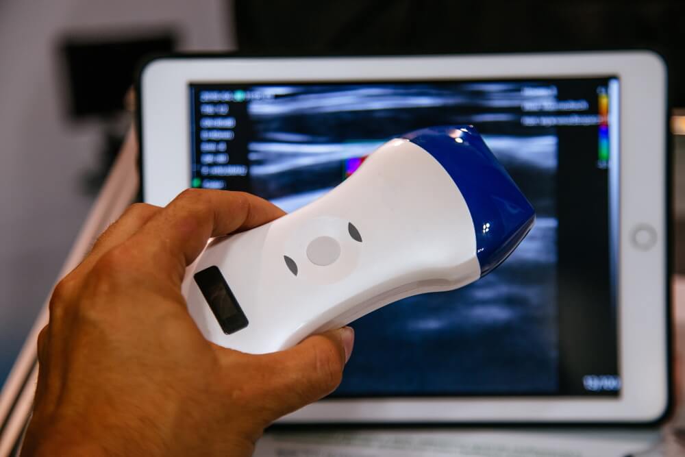 Medical Diagnosis Equipment Portable Small Mini Integrated