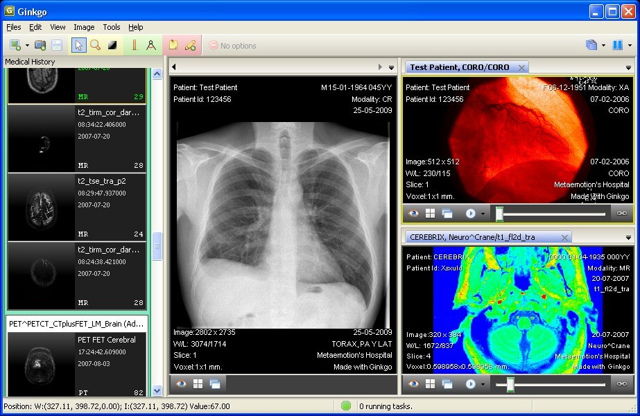 onis viewer for mac