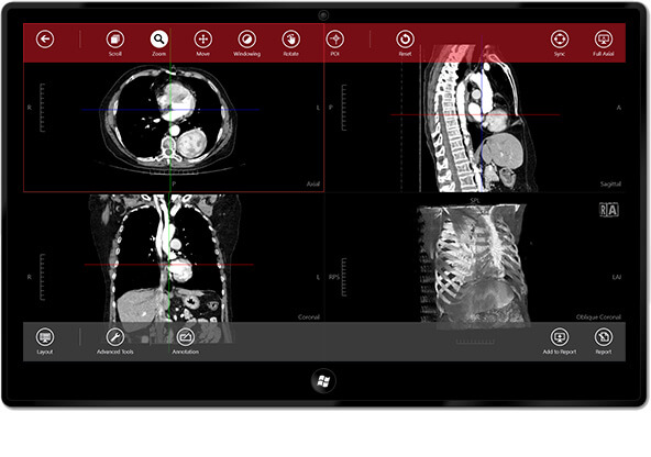 medical grade touch screen monitors dicom free sample