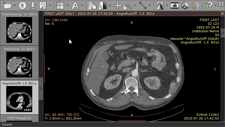 Radiant dicom viewer. Radiant Dicom viewer (64-bit). POSTDICOM. Radiant Dicom перфузия. Radiant Dicom флюид.