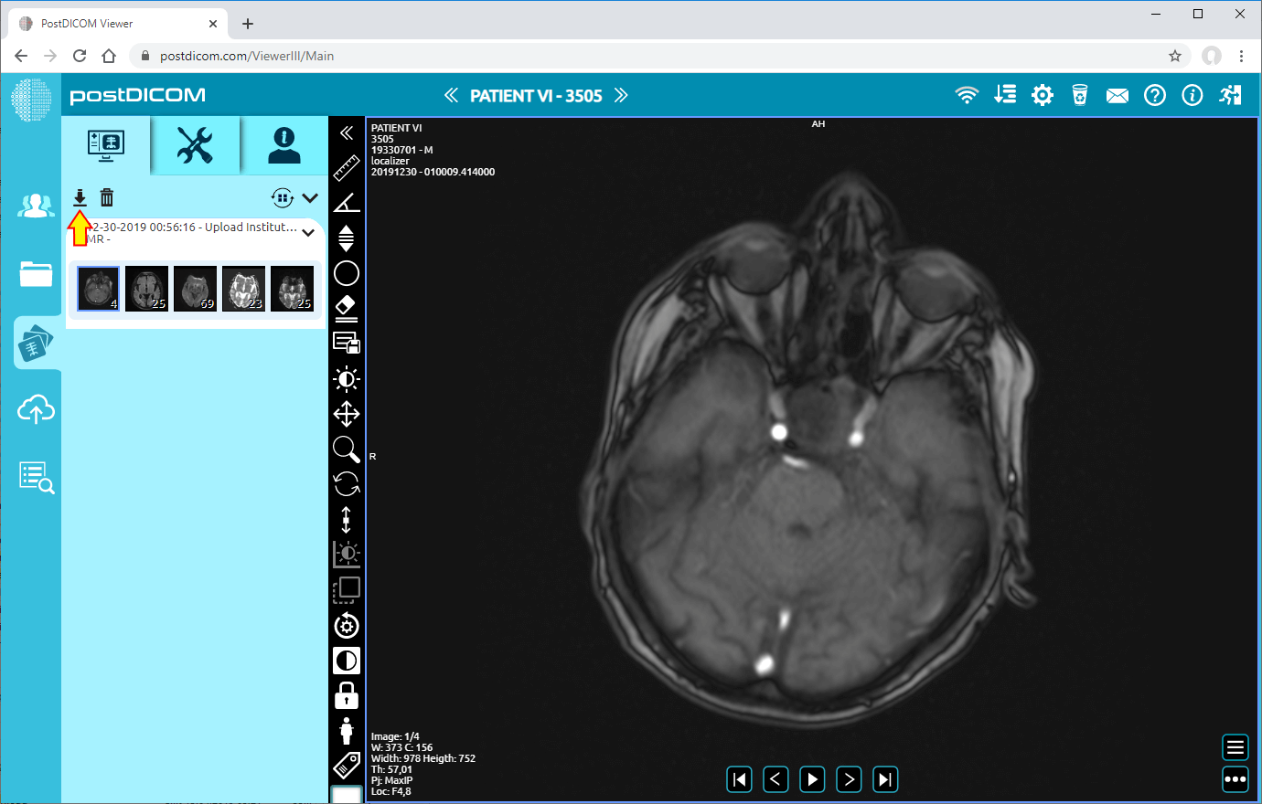 downloading patient images to disk