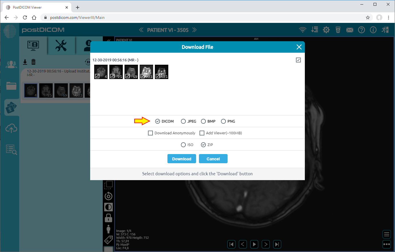 downloading patient images to disk