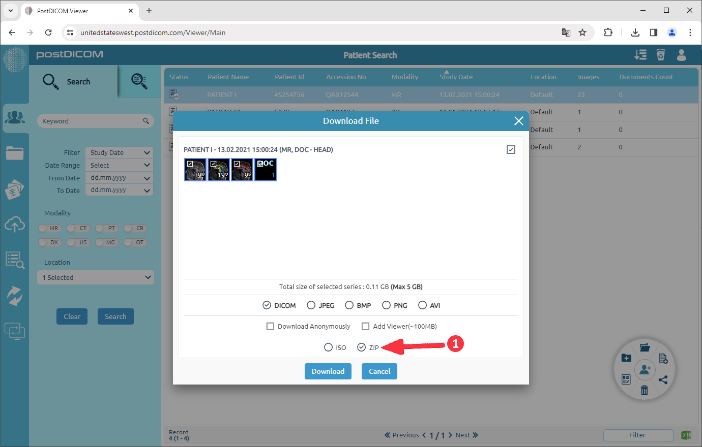 Downloading Patient Images to Disk