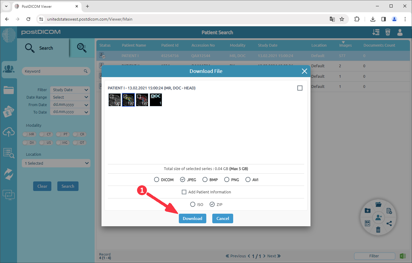 How to convert DICOM images to JPEG