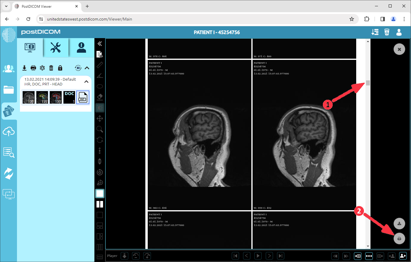 How to convert DICOM images to PDF