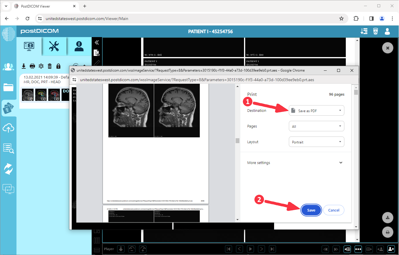 How to convert DICOM images to PDF