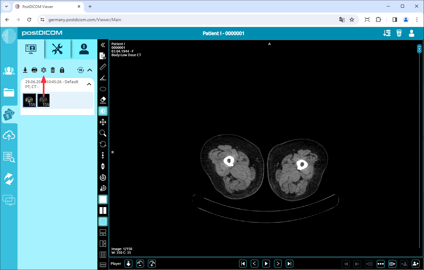 PET/CT, PET/MR Fusion