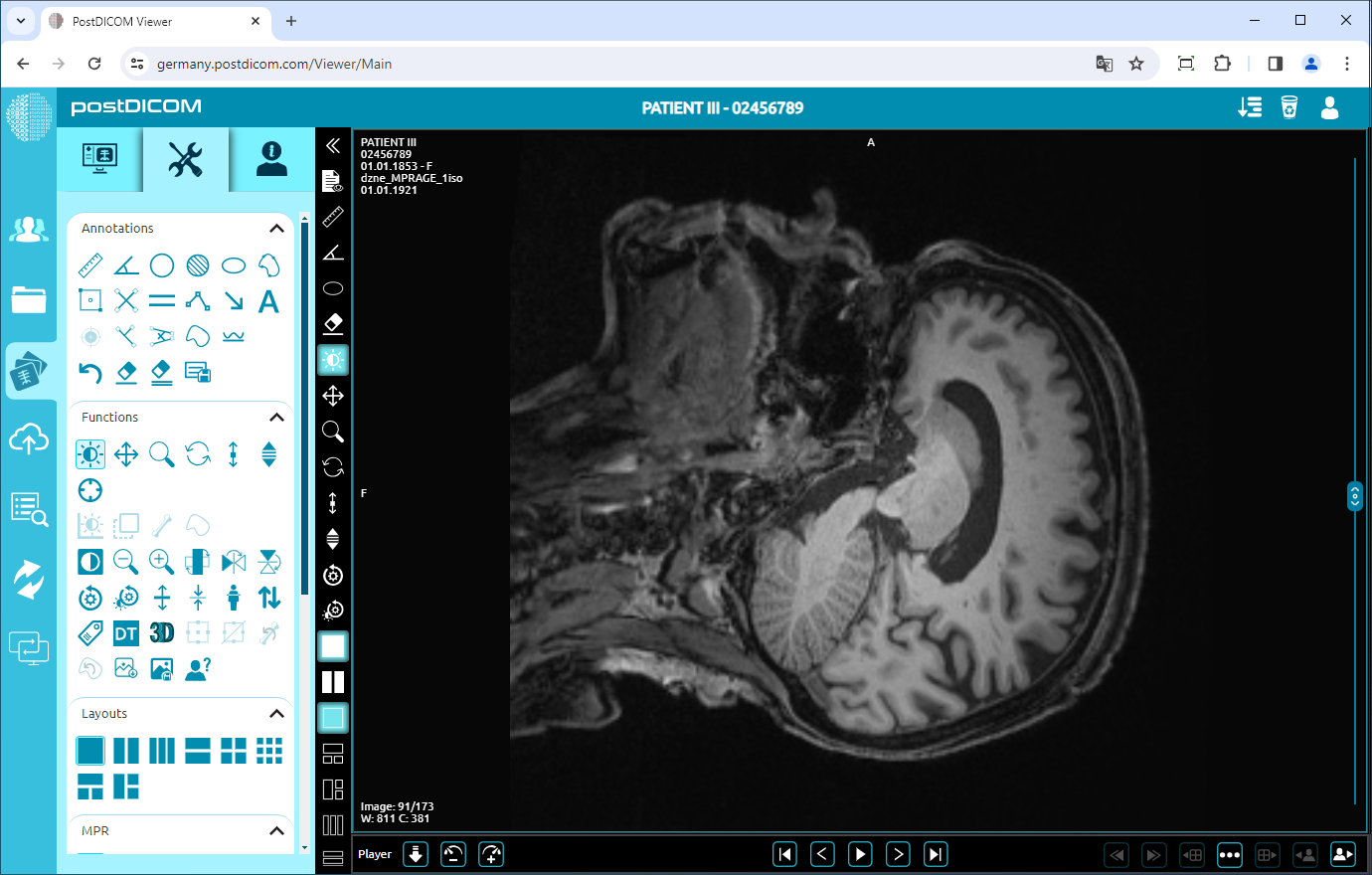 Using Negate, Rotate, Flip Vertical/Horizontal, Increase/Decrease Thickness, Zoom In/Out, Reset Functions