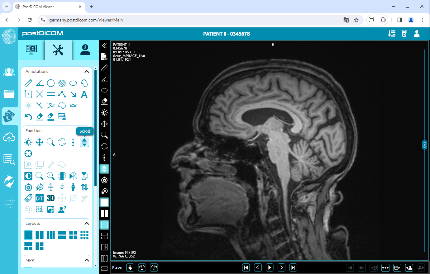 Using Window Level, Pan, Zoom, Rotation, Thickness and Scroll Functions