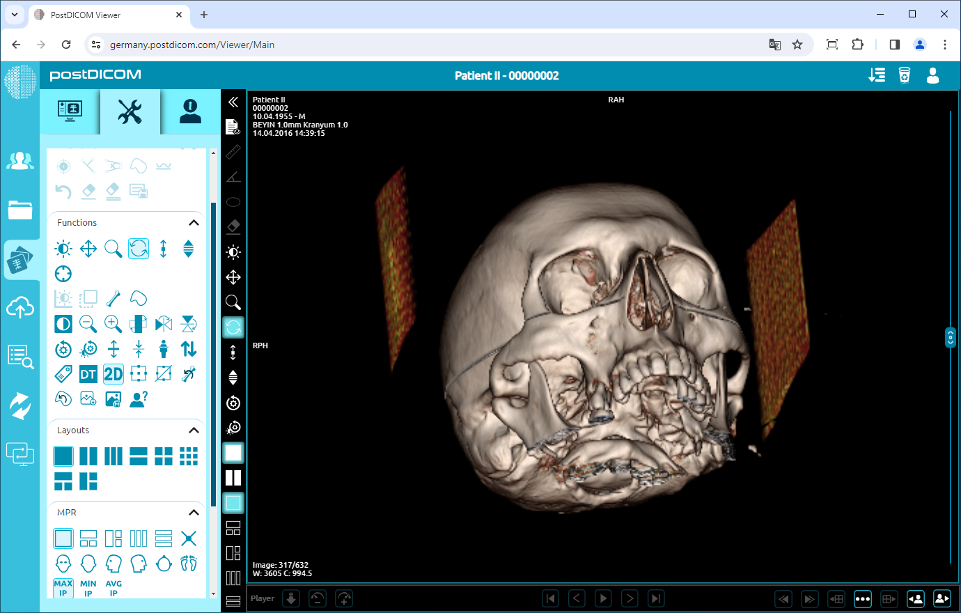 Viewing in 3D